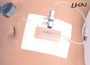 PROTECATH DP™ est un pansement imperméable avec bandelettes support connecteur, destiné aux patients en dialyse péritonéale.